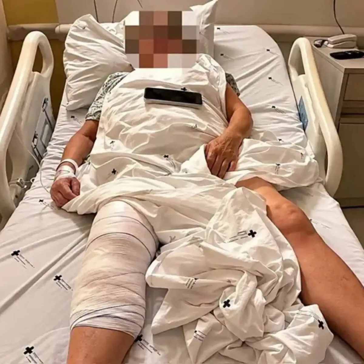 ‘Não poderia ter acontecido’, diz idosa que teve prótese implantada no joelho errado