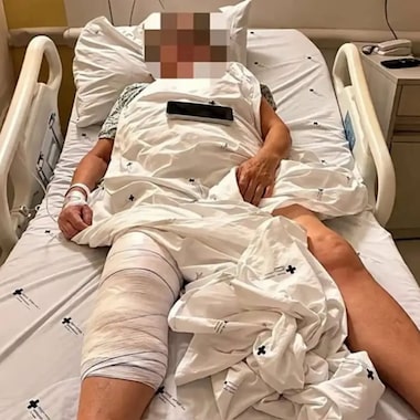 ‘Não poderia ter acontecido’, diz idosa que teve prótese implantada no joelho errado
